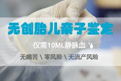 济南怀孕31天可以做怀孕亲子鉴定吗